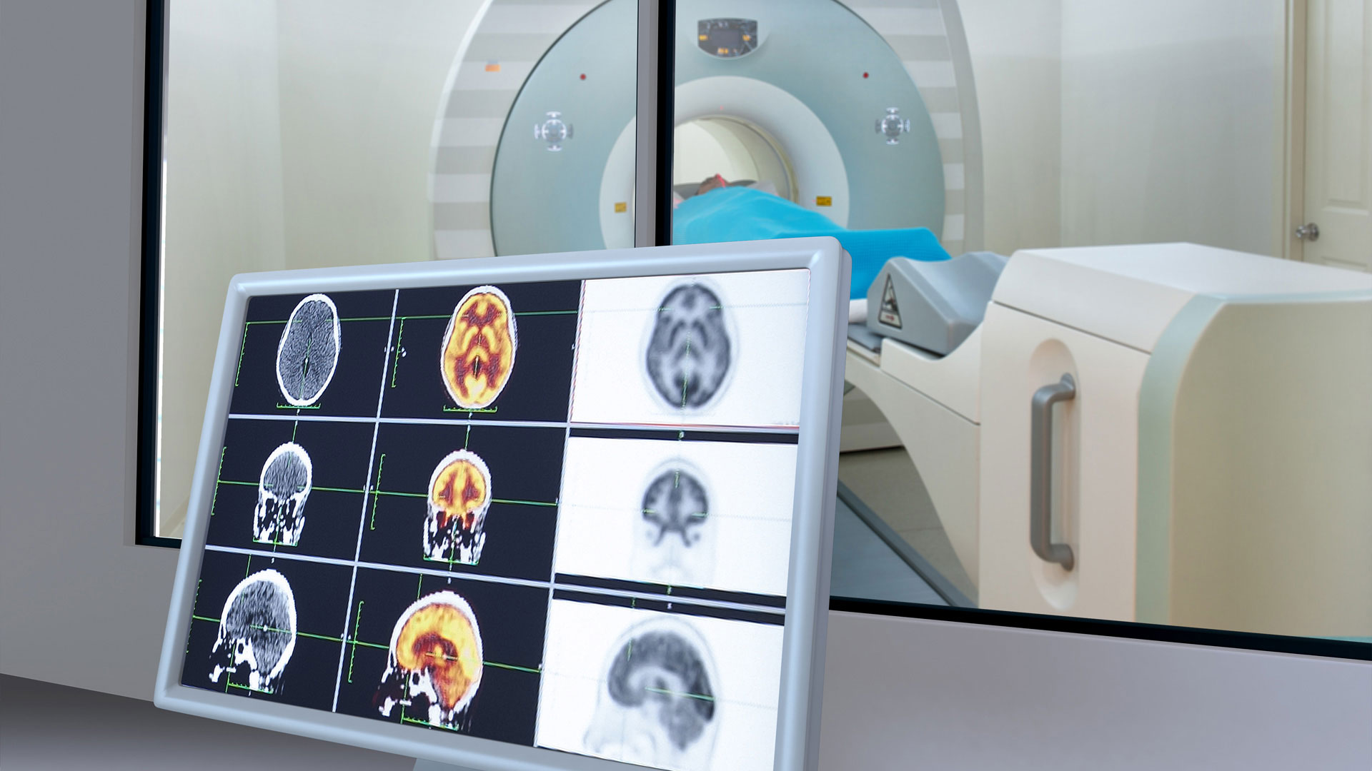 nuclear-medicine-solumedics-innovative-treatment